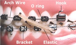 Orthodontic Chart